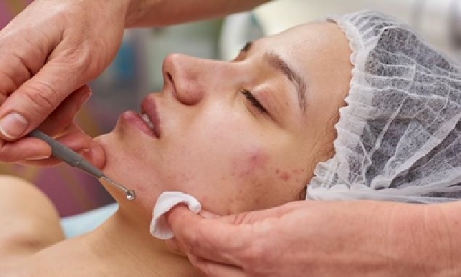 Fight Against Acne